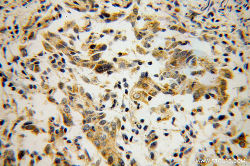 SDHC Polyclonal antibody