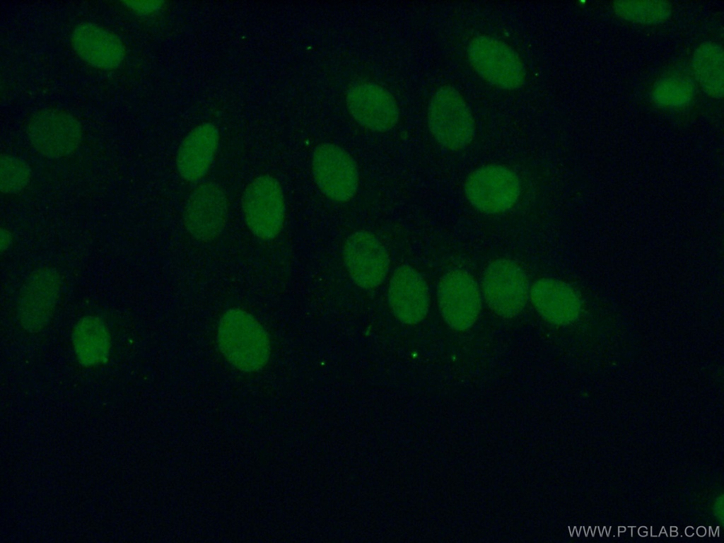 ERCC1 Polyclonal antibody