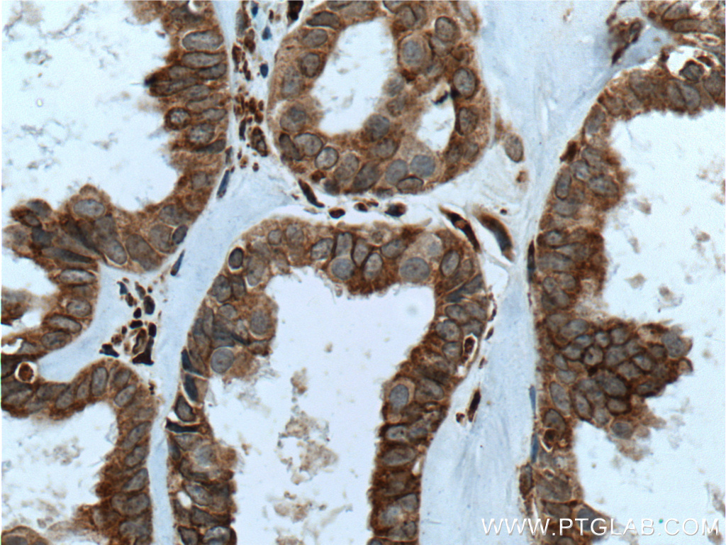 IKIP Polyclonal antibody