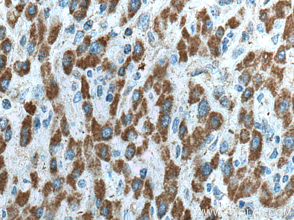 HIBCH Polyclonal antibody