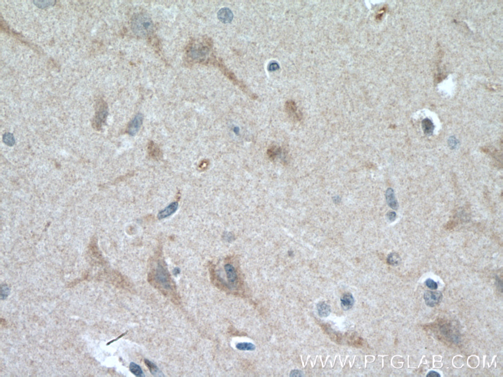SMPD1,ASM Polyclonal antibody