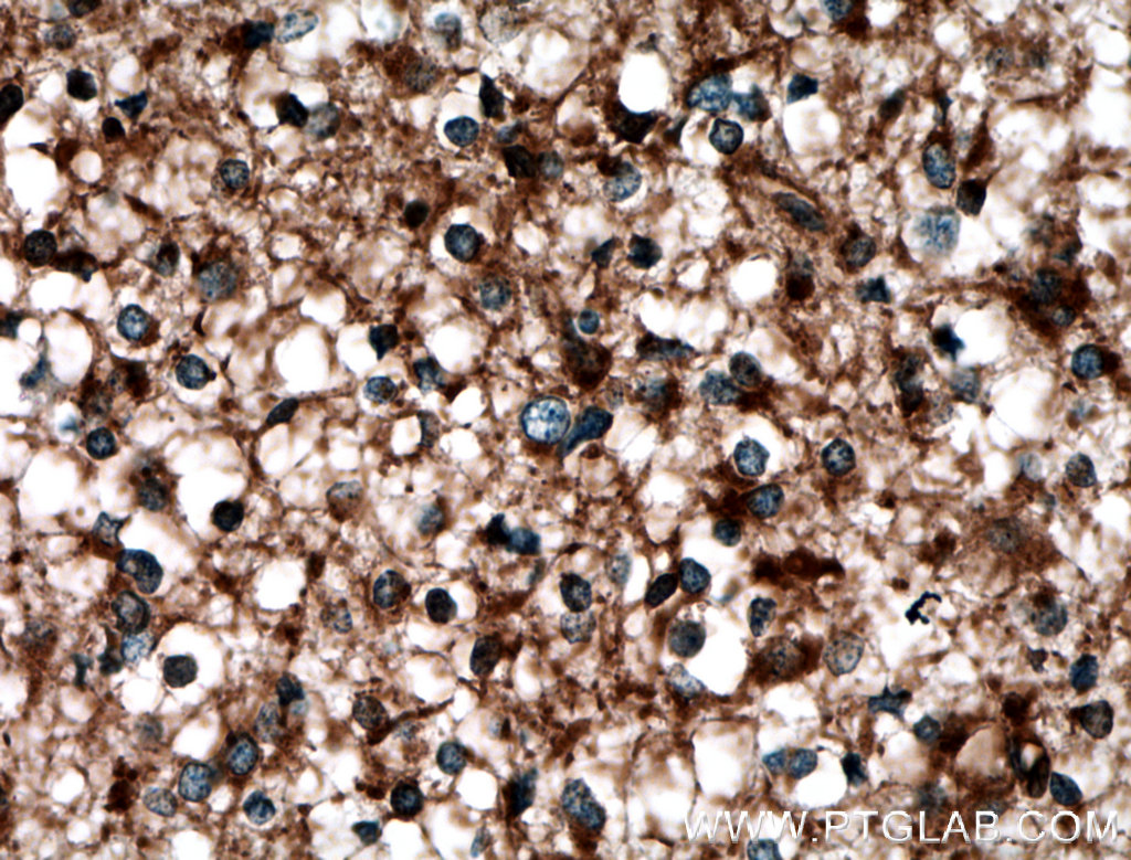 LAP3 Polyclonal antibody