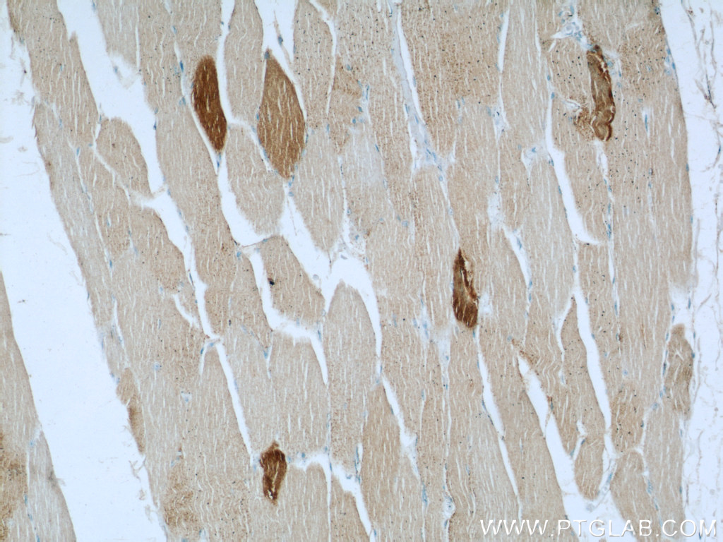 ST3GAL5 Polyclonal antibody