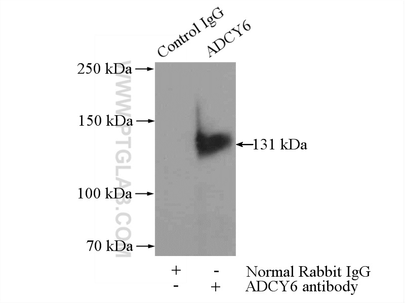 ADCY6 Polyclonal antibody