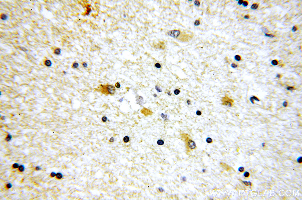 SV2B Polyclonal antibody