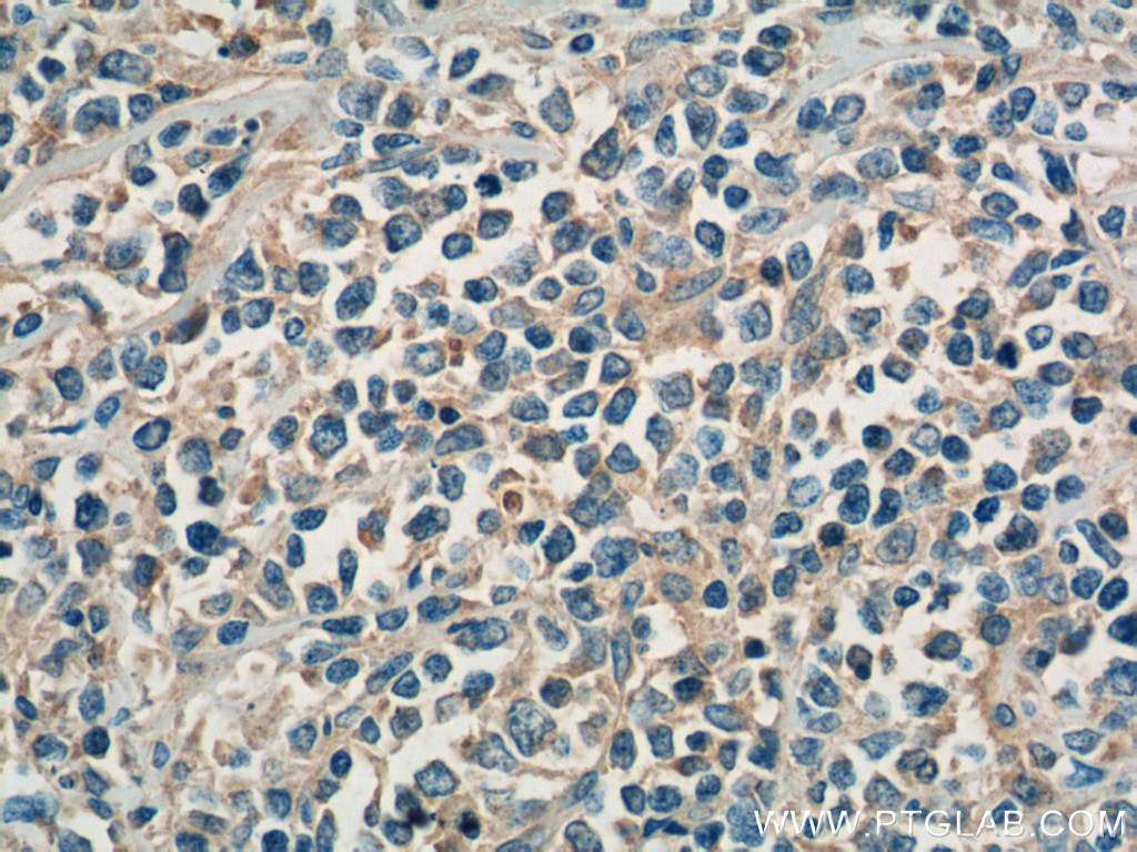 SHARPIN Polyclonal antibody