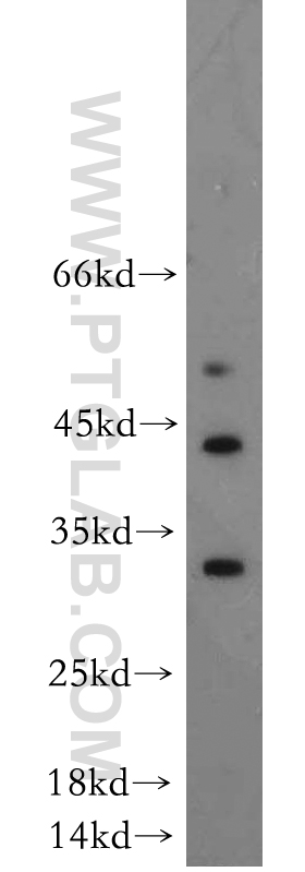 DUSP15 Polyclonal antibody