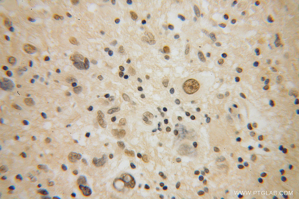 RMI1 Polyclonal antibody