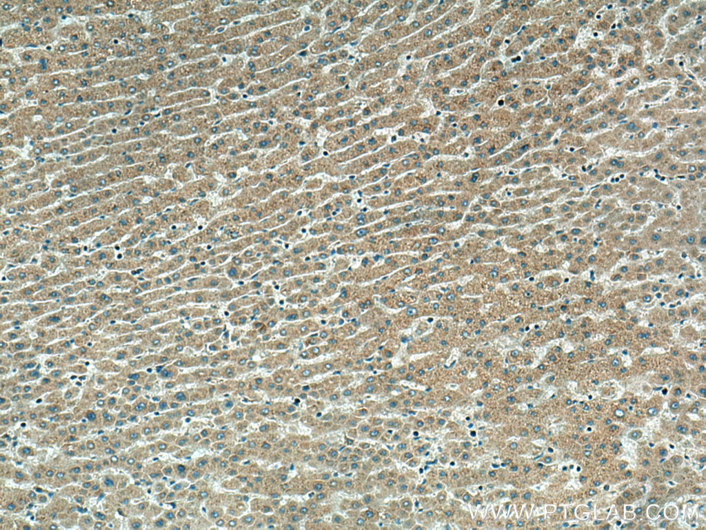 SRPRB Polyclonal antibody