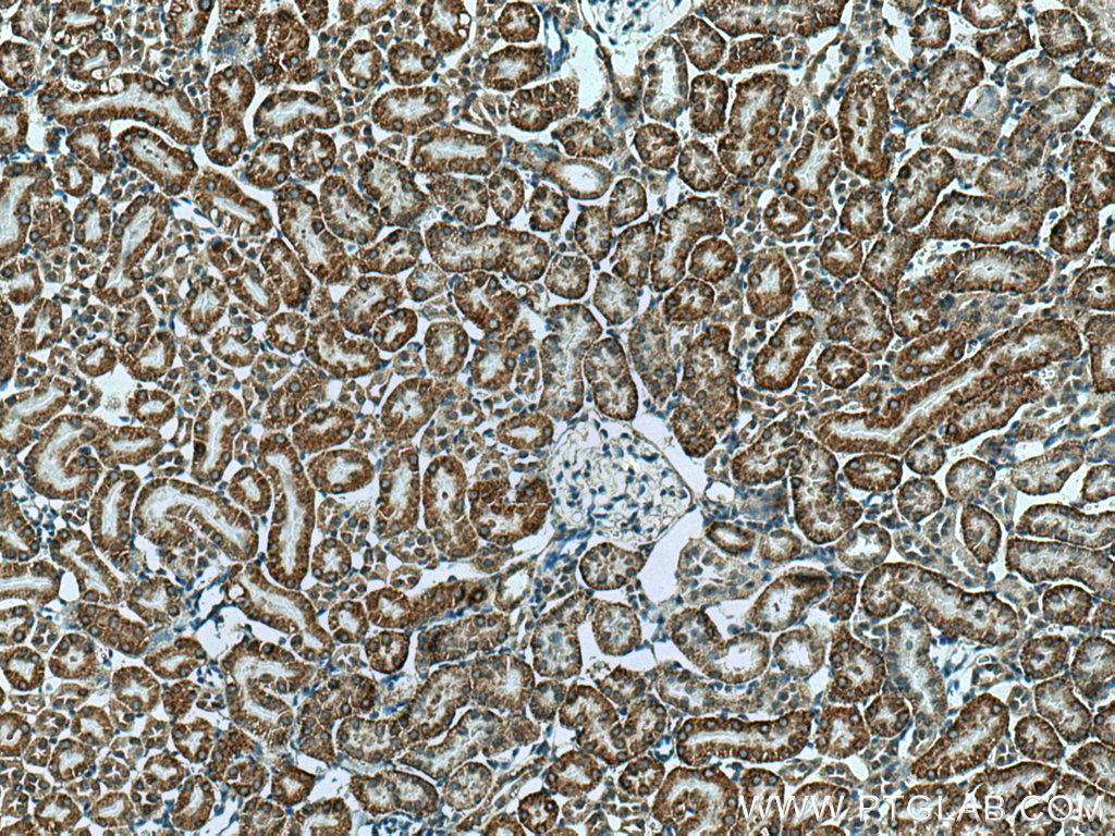 RDH10 Polyclonal antibody