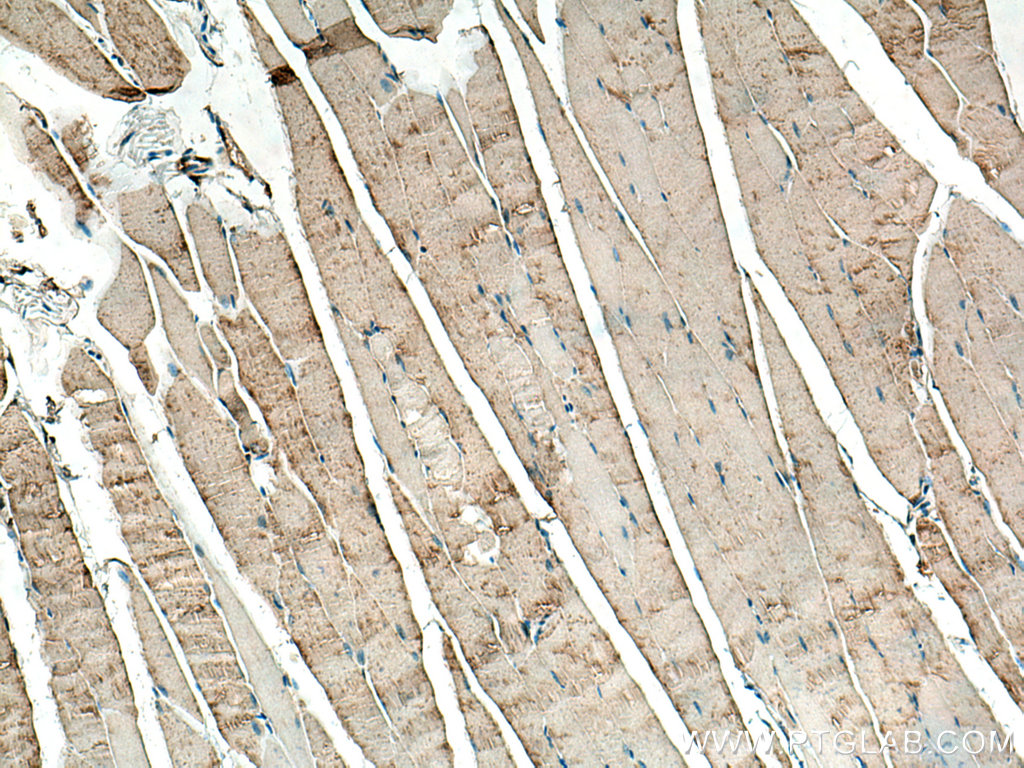 BIN1 Polyclonal antibody