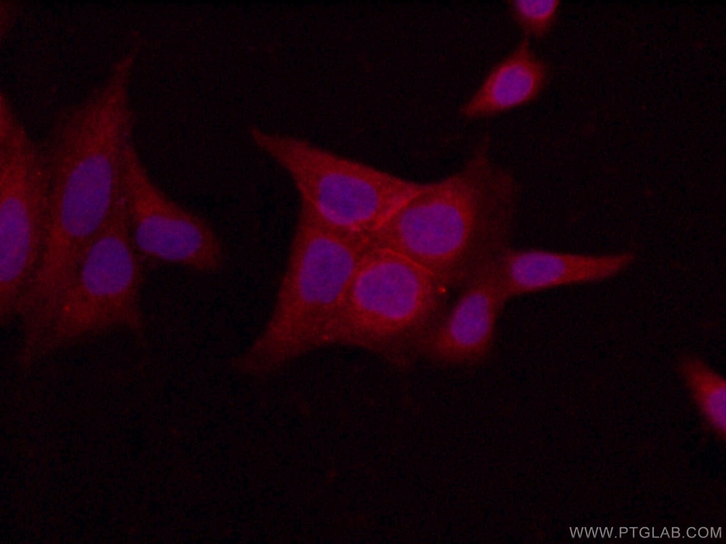 LIN7C Polyclonal antibody