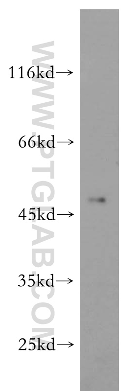 ELK4 Polyclonal antibody