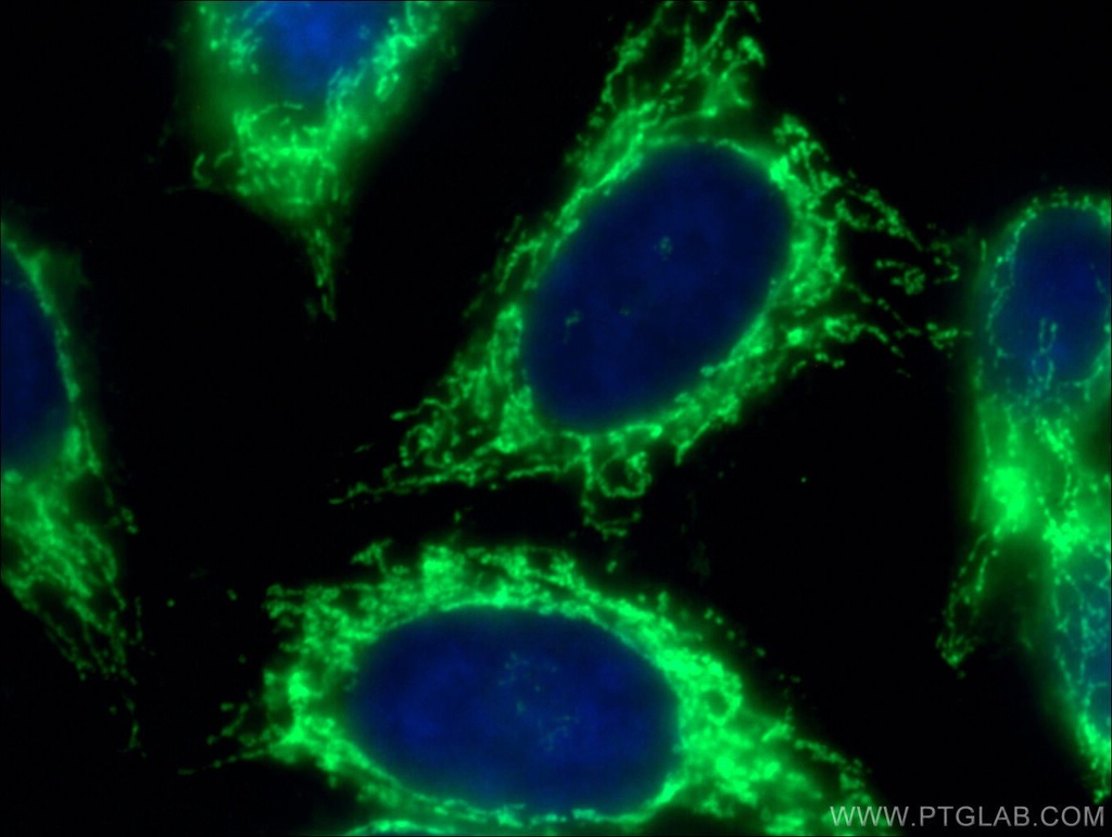 ATP5A1 Polyclonal antibody