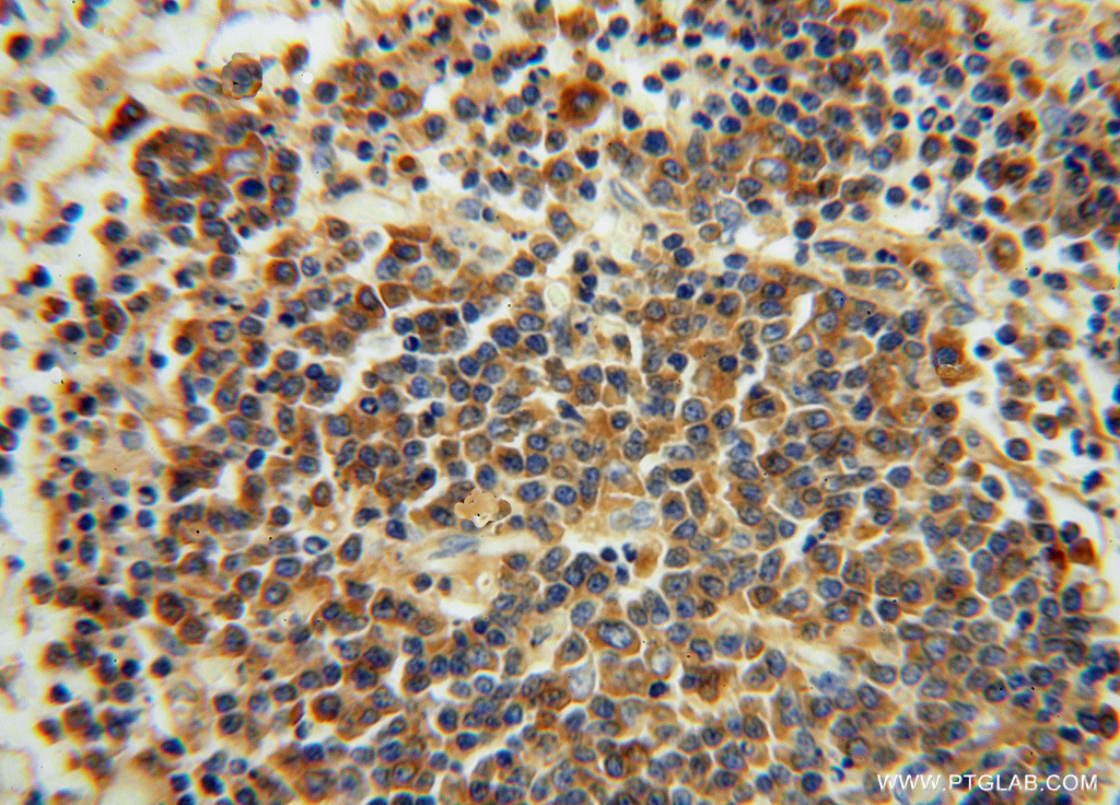 IgG Kappa Light Chain Polyclonal antibody