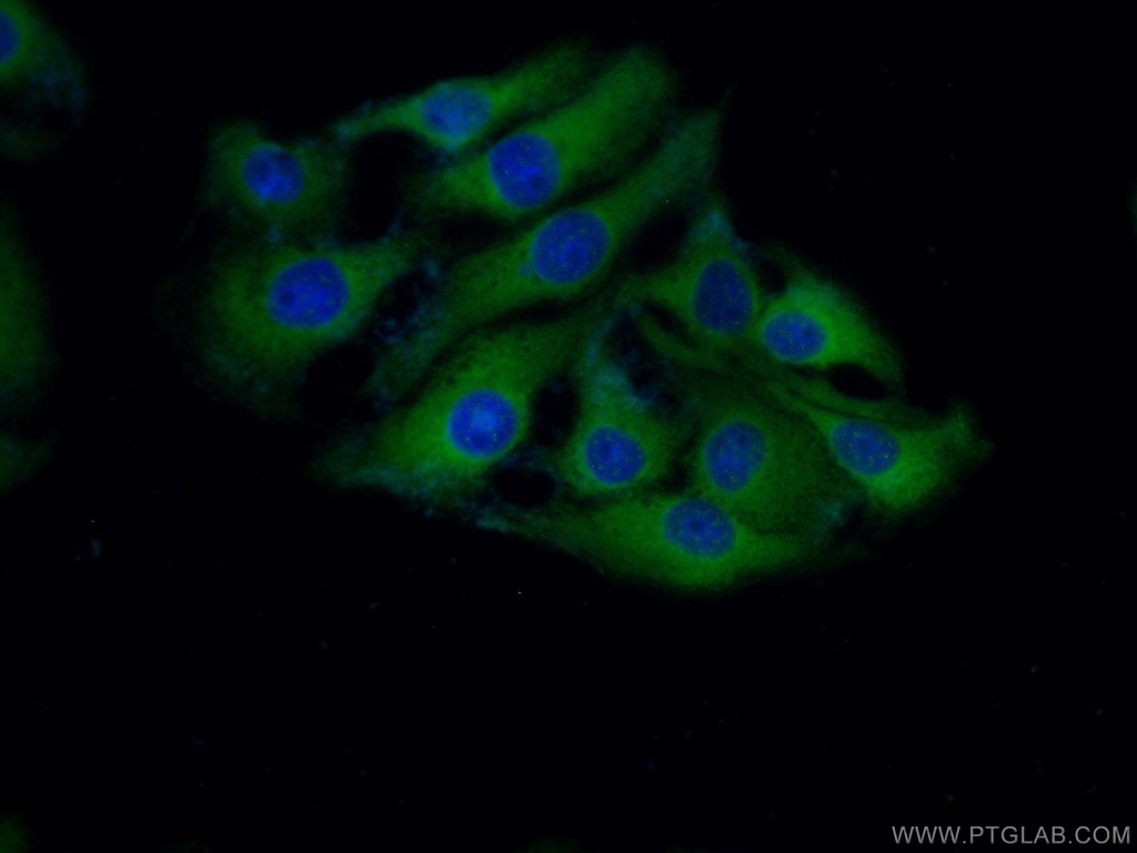 ASNS Polyclonal antibody