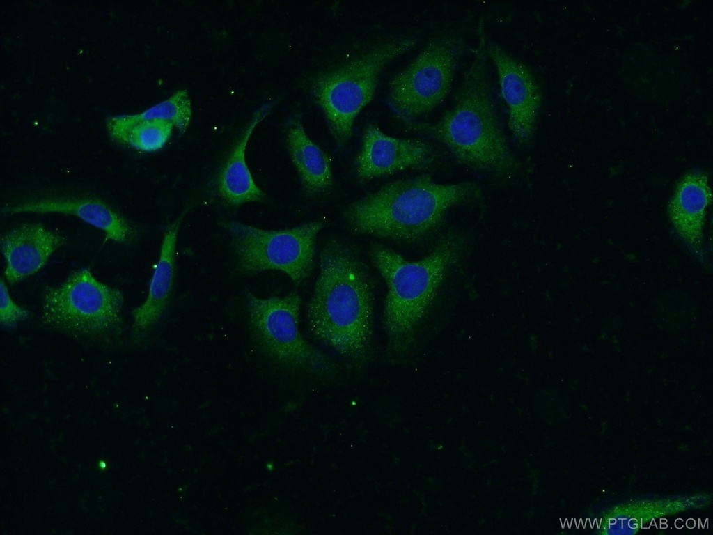 NBAS Polyclonal antibody
