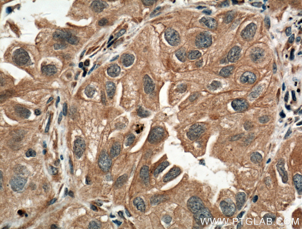 SLC44A1 Polyclonal antibody