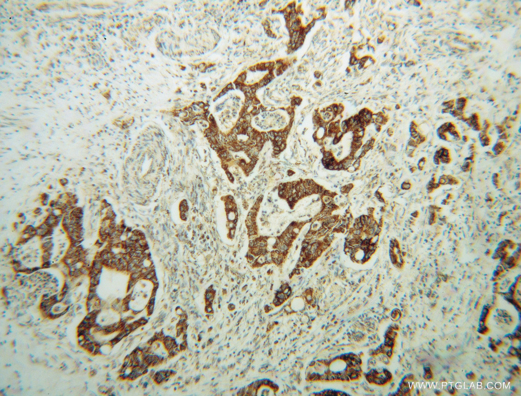 AMN1 Polyclonal antibody
