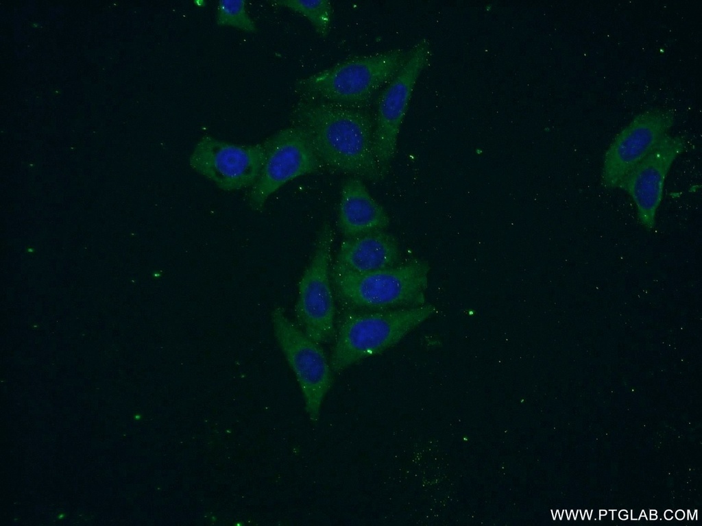 SEC6 Polyclonal antibody
