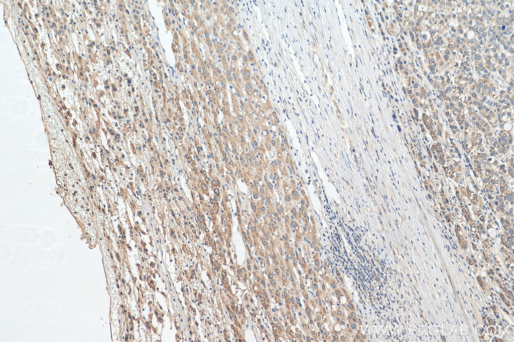 PEX19 Polyclonal antibody