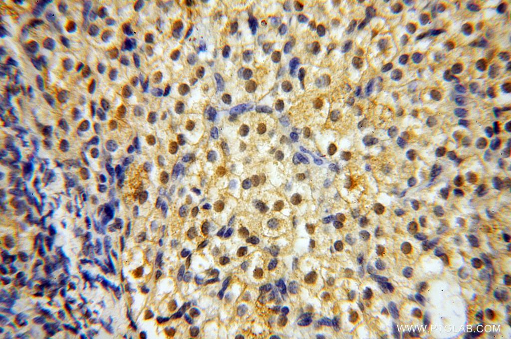 CNBP Polyclonal antibody