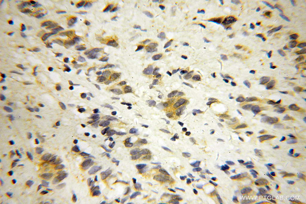 DNM3 Polyclonal antibody