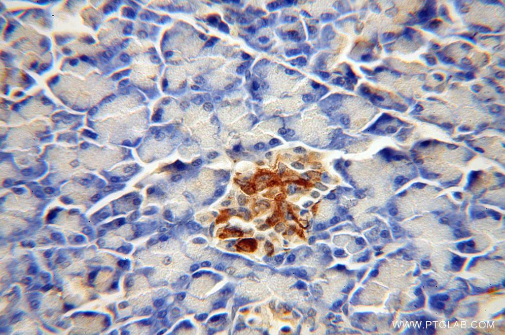 CDK5RAP1 Polyclonal antibody