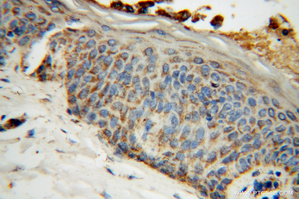 PDHB Polyclonal antibody
