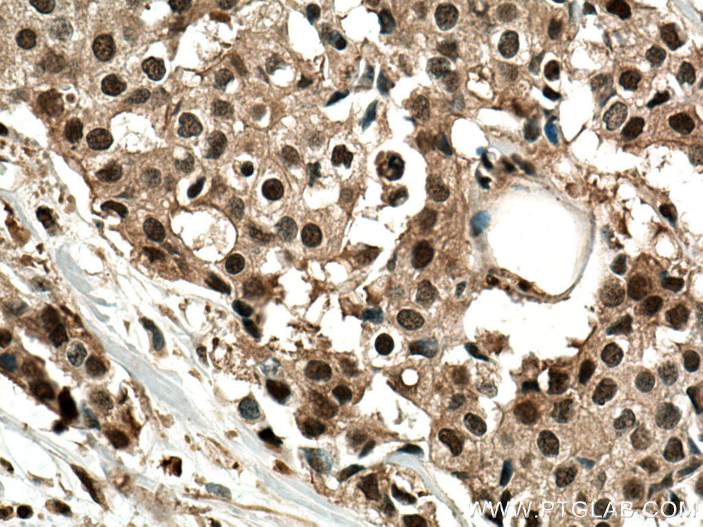 PSMD2 Polyclonal antibody