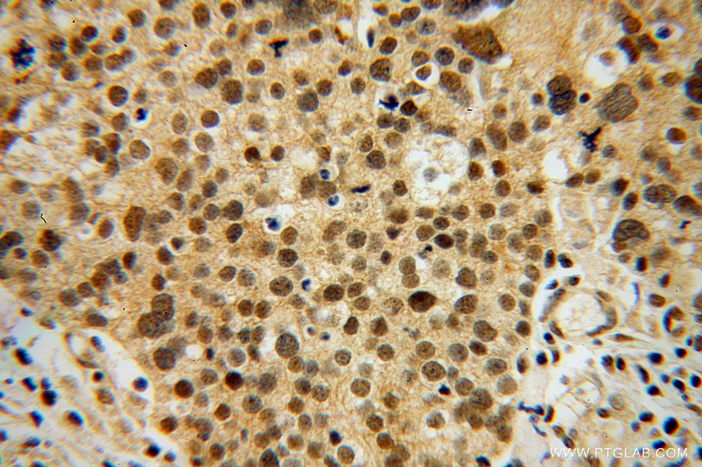 OSBPL2 Polyclonal antibody