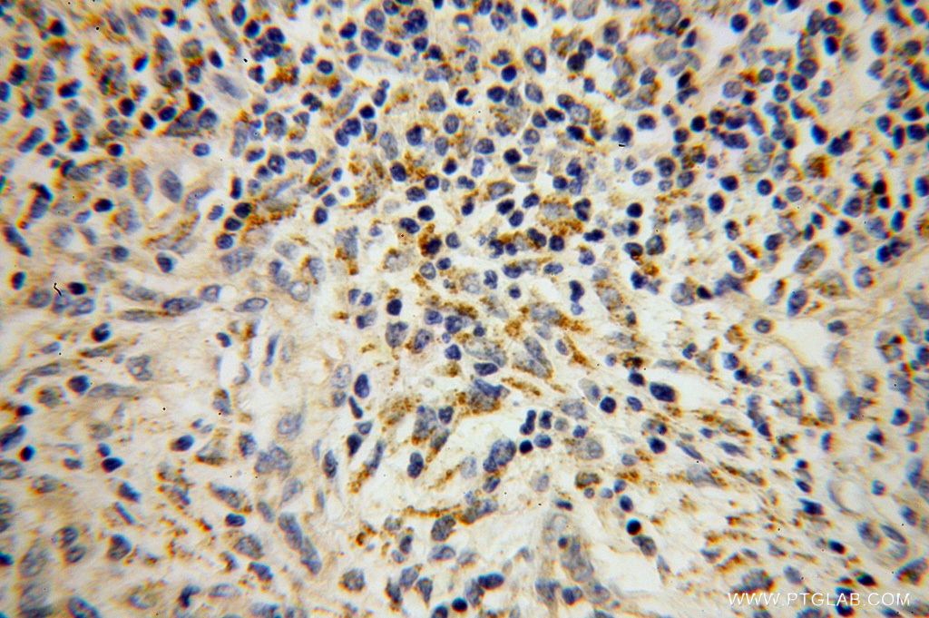 SEC11A Polyclonal antibody