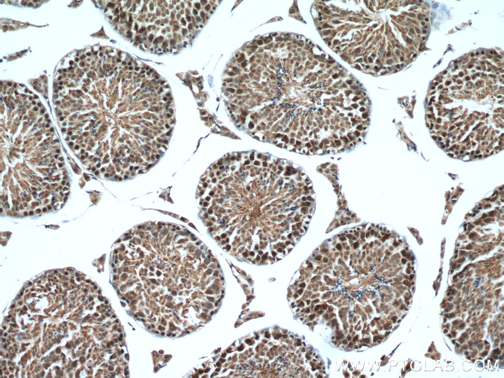 WRAP53 Polyclonal antibody