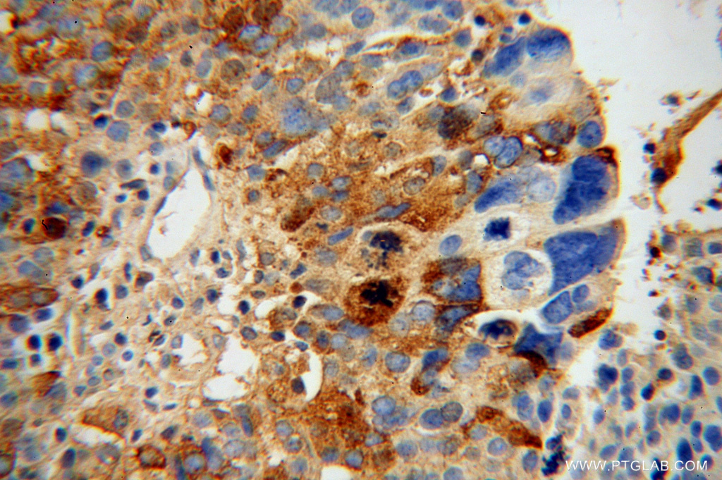 NLN Polyclonal antibody