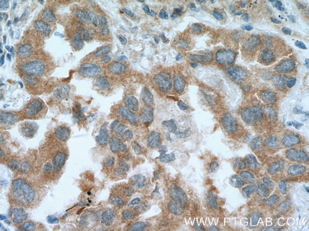 RNPEP Polyclonal antibody