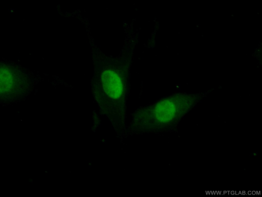 FEN1 Polyclonal antibody