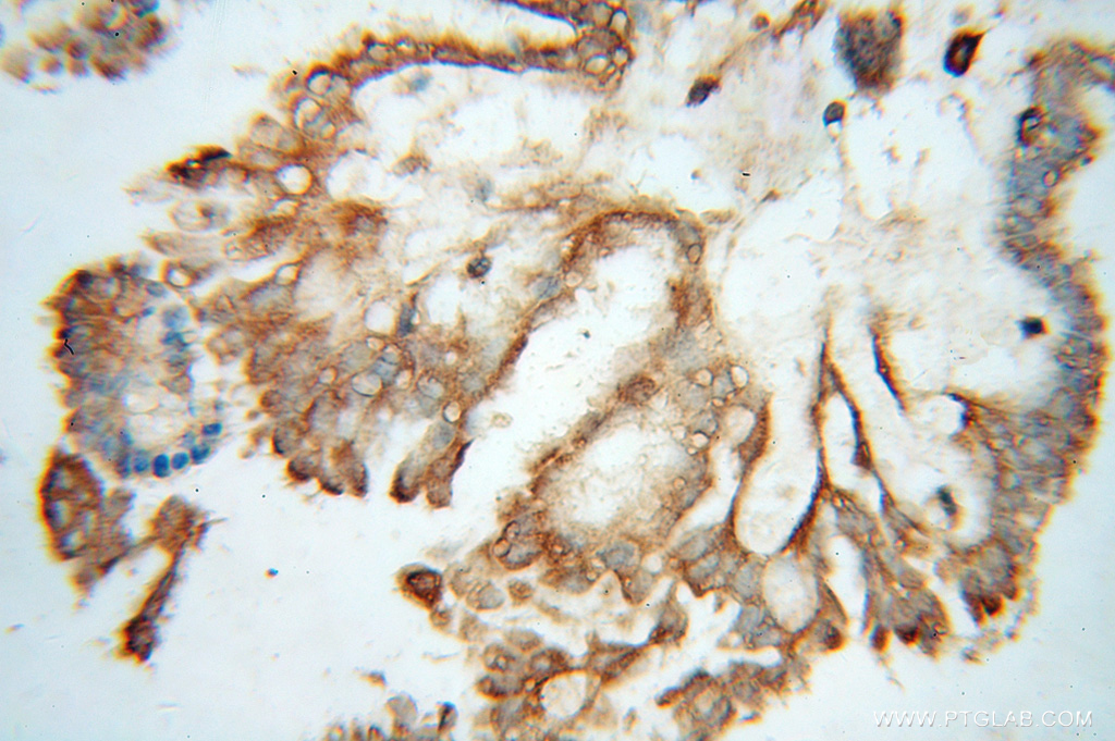 AIFM3 Polyclonal antibody