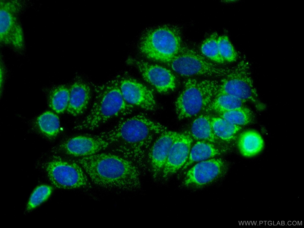 SMTNL2 Polyclonal antibody