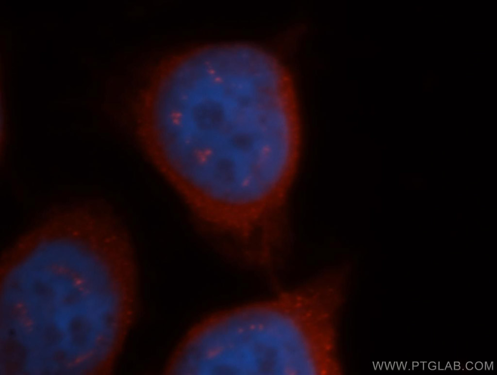 CBS Polyclonal antibody