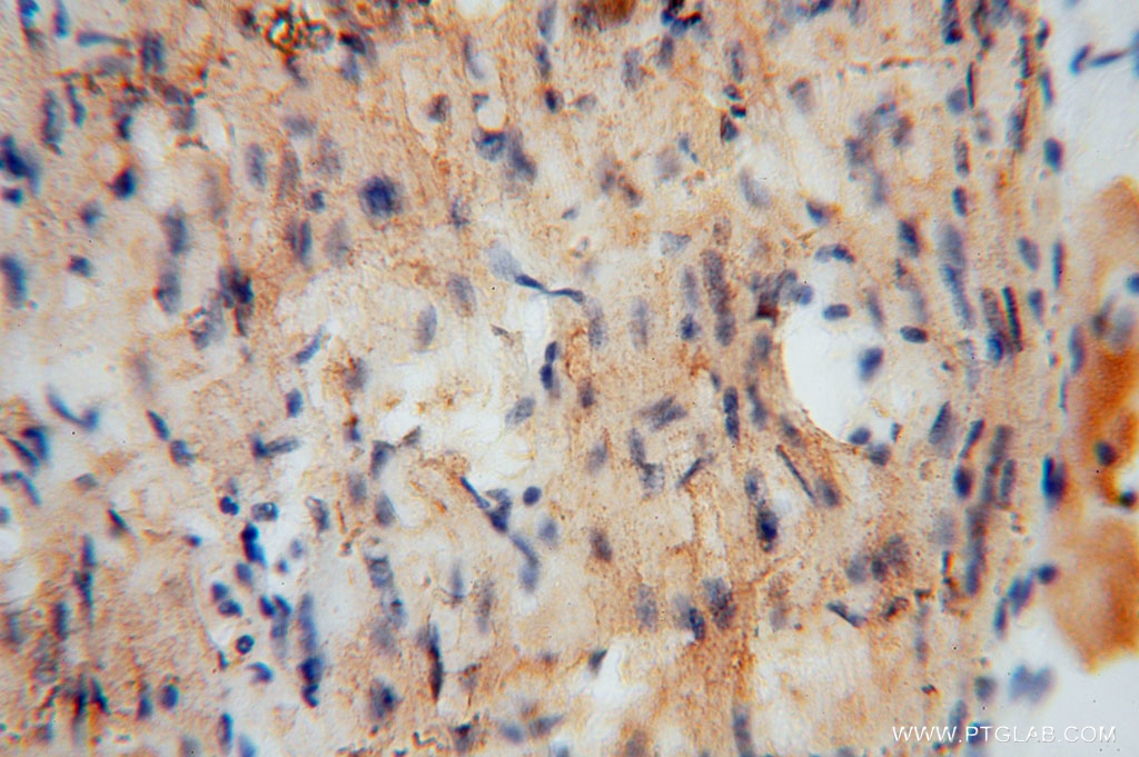 UQCR Polyclonal antibody