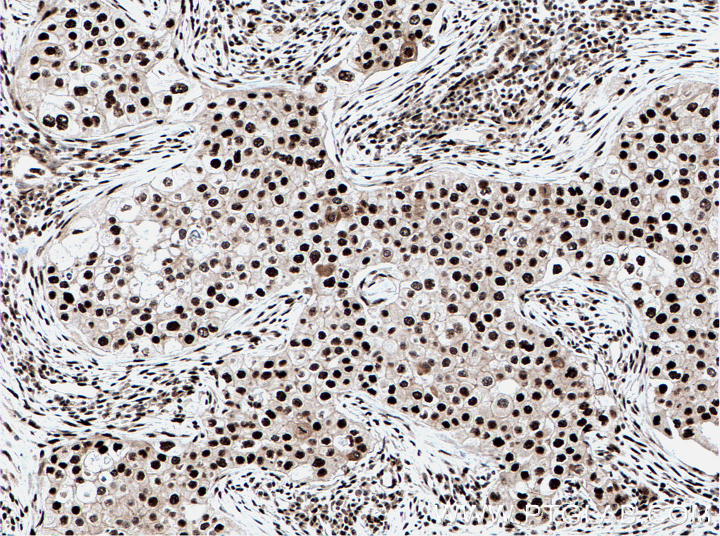 DDX39B Polyclonal antibody