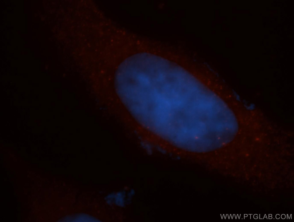CCDC28A Polyclonal antibody