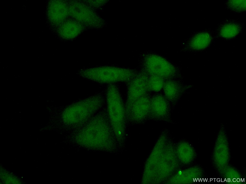 HNRNPA2B1 Polyclonal antibody
