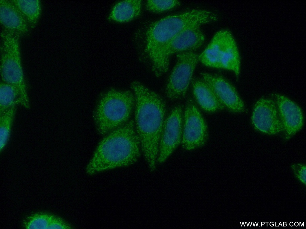 PCYT2 Polyclonal antibody
