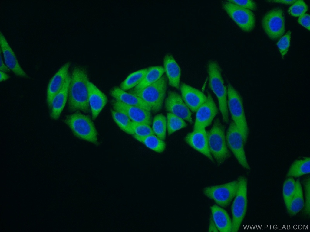MARS Polyclonal antibody