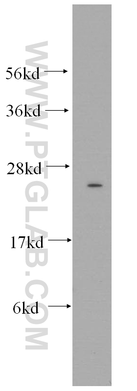 Connexin-26 Polyclonal antibody