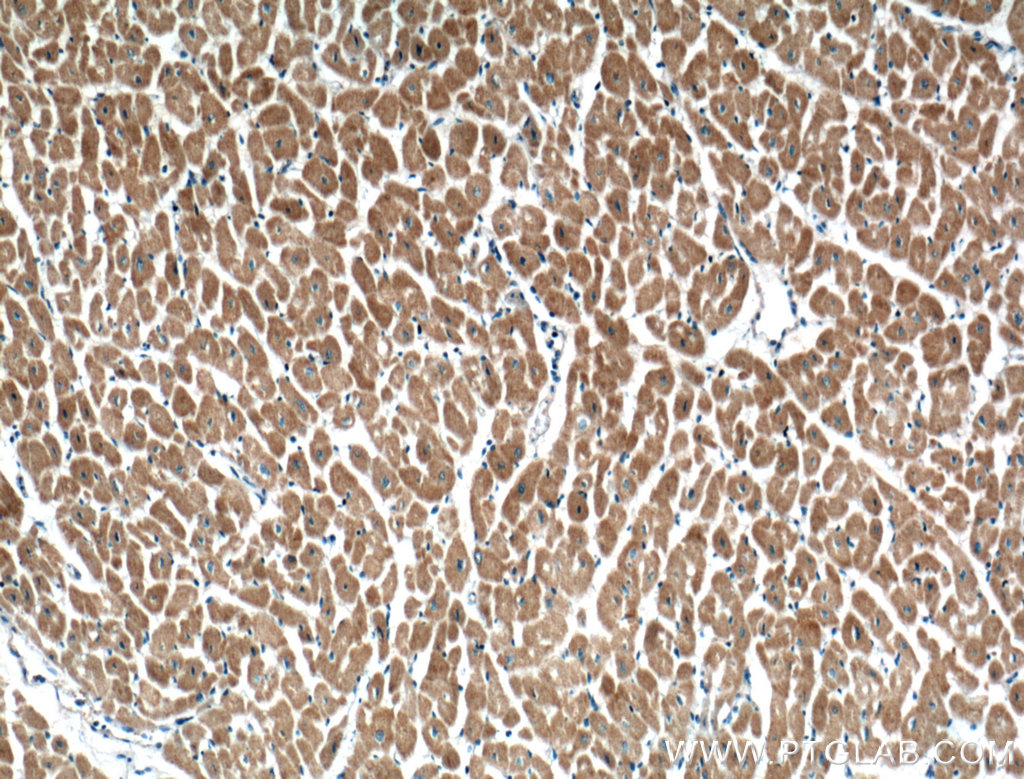 CRLS1-Specific Polyclonal antibody