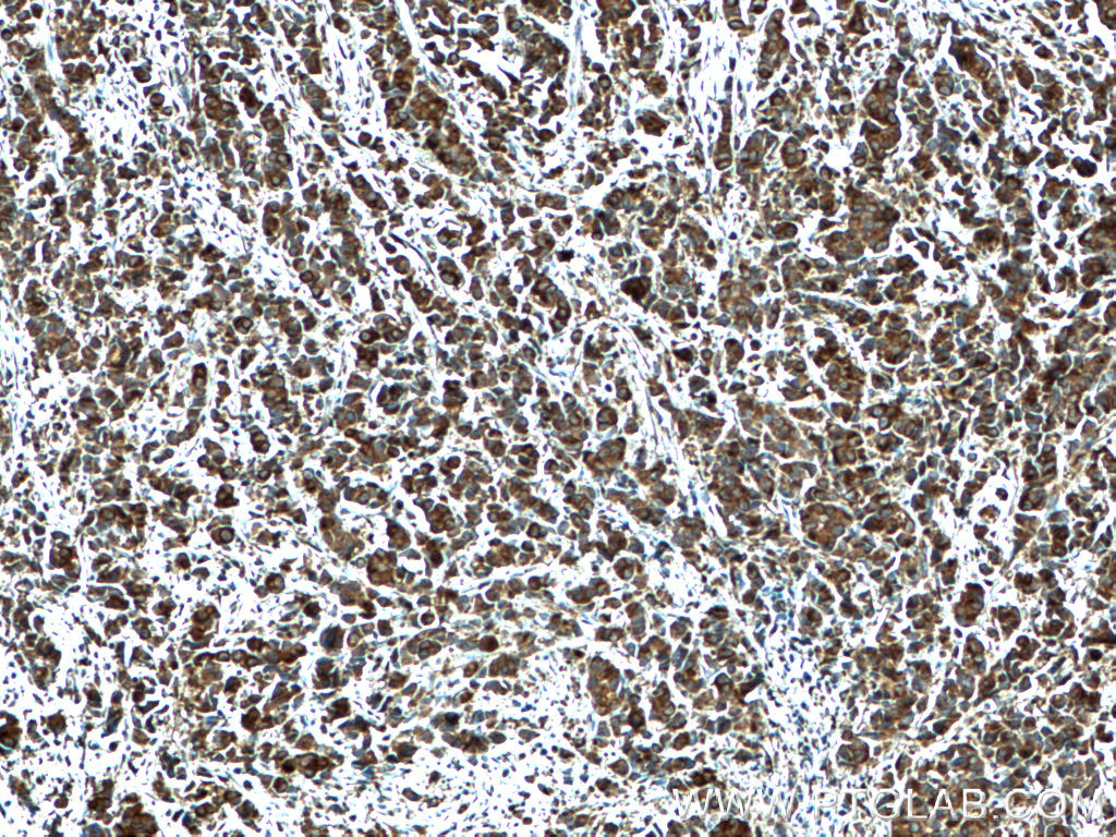 CRISP3 Polyclonal antibody