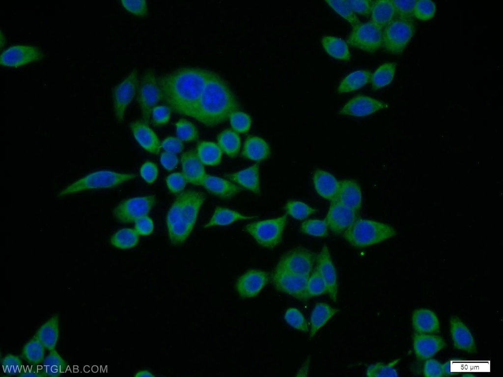 CTRL Polyclonal antibody