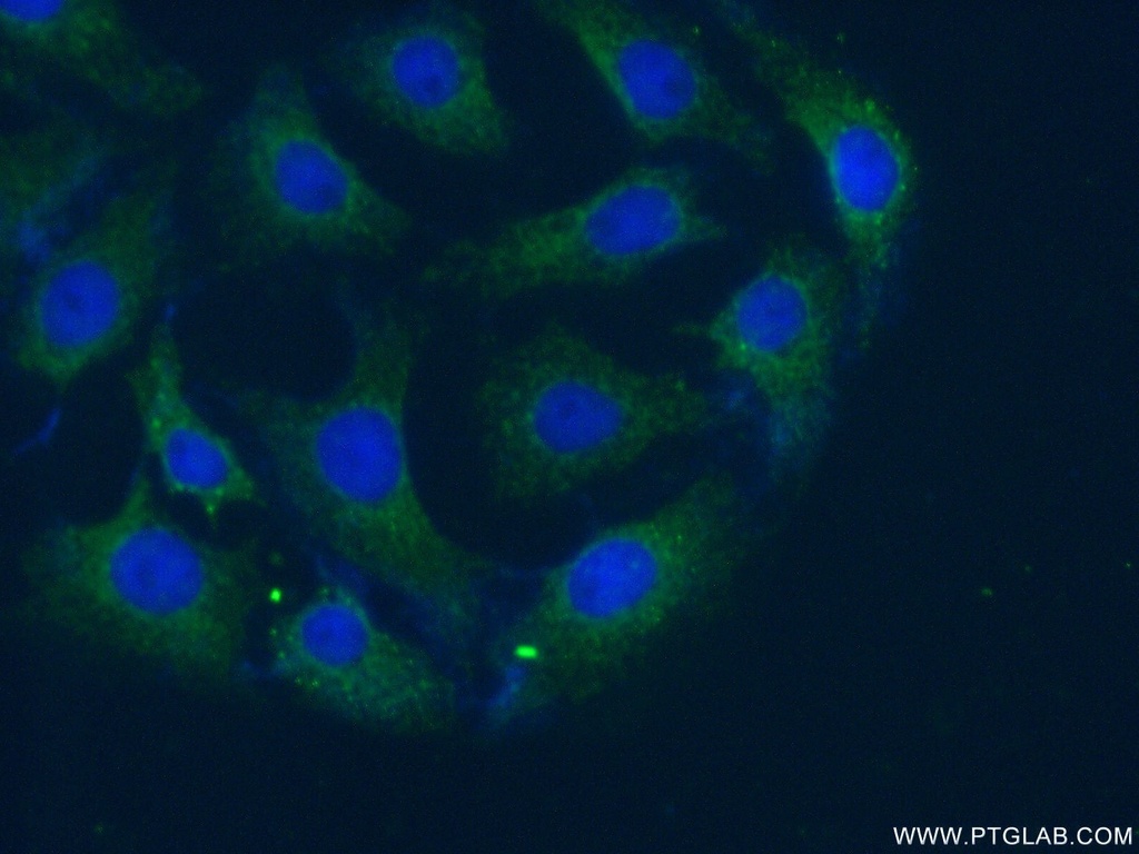 AKTIP Polyclonal antibody